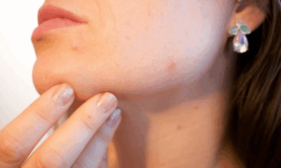 Kulit Bruntusan ingin Glowing? Terapkan Tips Kecantikan Ini!