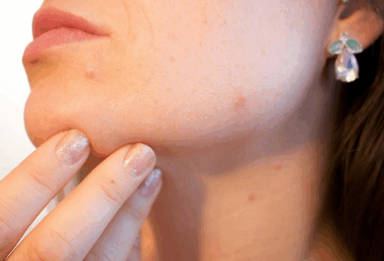 Kulit Bruntusan ingin Glowing? Terapkan Tips Kecantikan Ini!