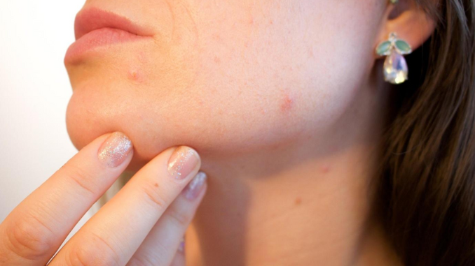 Kulit Bruntusan ingin Glowing? Terapkan Tips Kecantikan Ini!